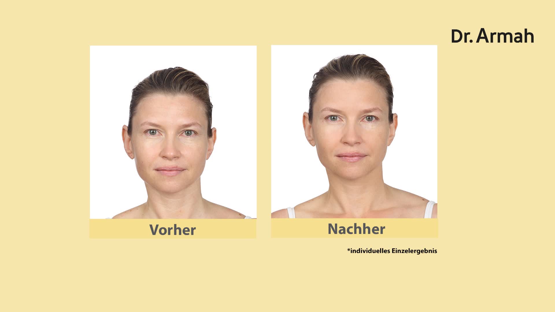 Produktabbildung 2